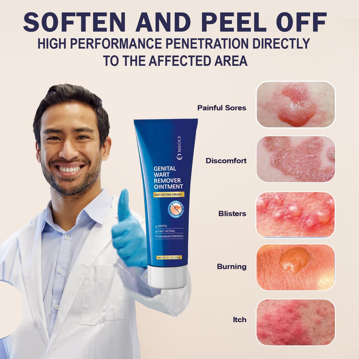 Genital Wart Remover Cream 0.7 oz I4271