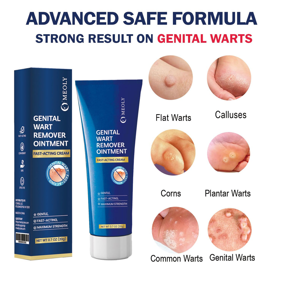 Genital Wart Remover Cream 0.7 oz I4271